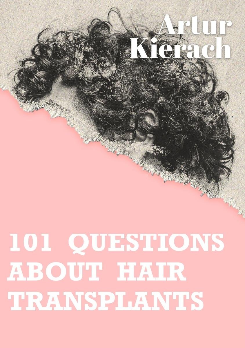 101 questions about hair transplants okładka