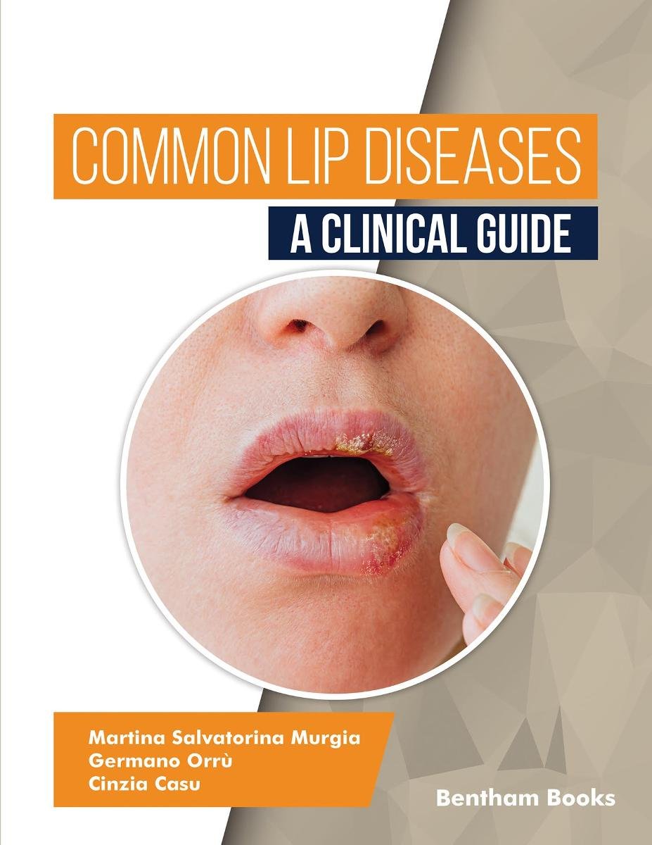 Common Lip Diseases. A Clinical Guide okładka